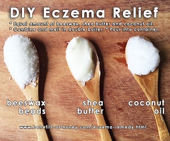 eczema remedy with beeswax poster image